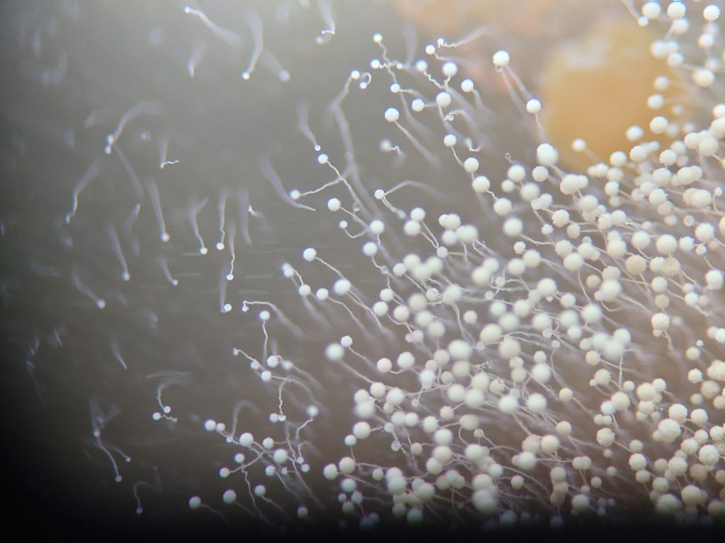 「3つの原因」改善のカギは微生物!